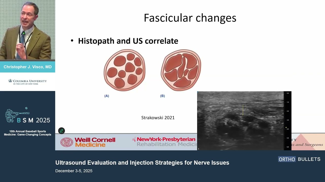 Ultrasound Evaluation and Injection Strategies for Nerve Issues_Christopher J. Visco MD