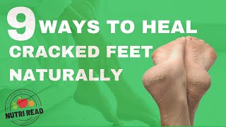 9 Amazing Ways to Heal Cracked Feet with Natural Home Remedies