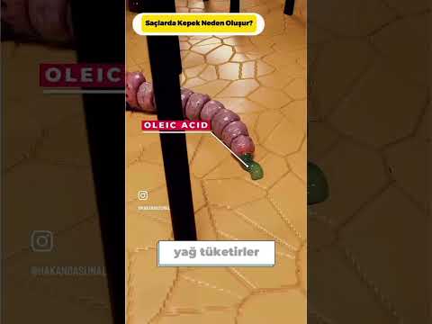 Kepekli Saçlar için Çözüm