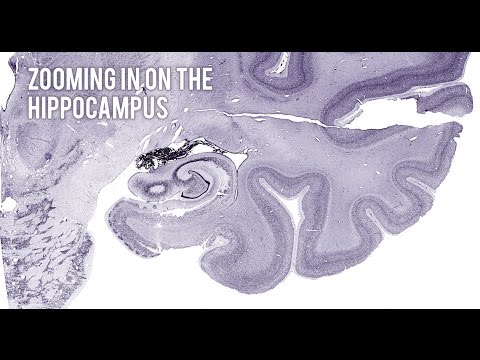 Zooming in on the hippocampus
