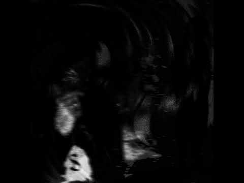 MAYDON X LYNCH VILLAIN - NEWBALANCE [Official Audio]