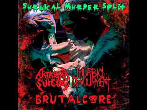 SURGICAL MURDER SPLIT,2011-Aktarma Suicide/Morbid Devourment/Brutalcore