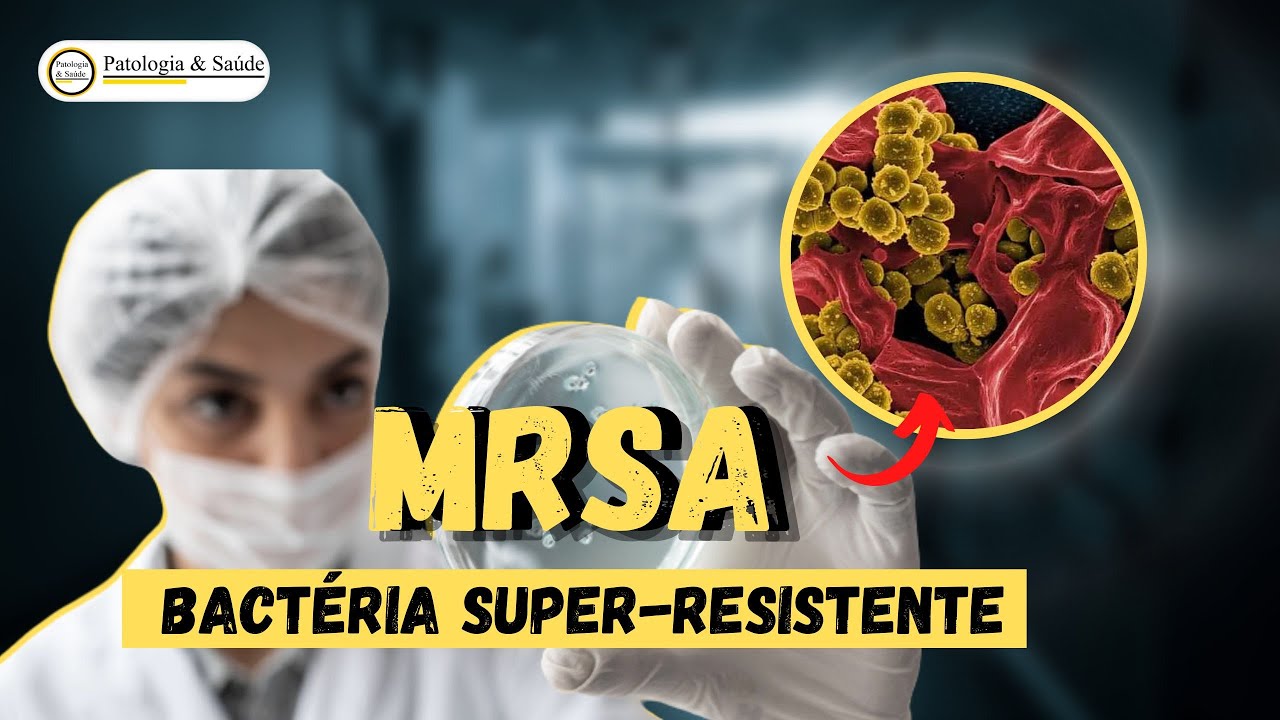 Bactérias resistentes a antibióticos: Elas podem viver em nossos corpos?