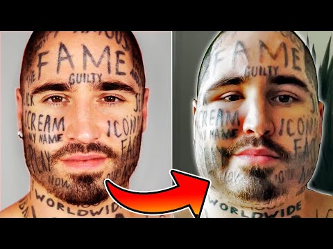 Se BORRA los TATUAJES de la CARA con LÁSER y ACABA ASÍ 😥