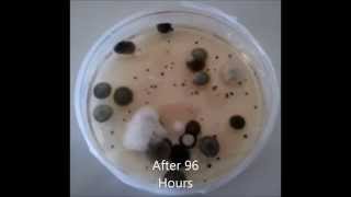 Medicare.gov - Is your Nursing Home clean? Having a "Five Star" rating doen't mean it's clean.