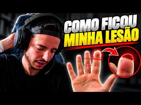 ACF FALA COMO FICOU SUA LESÃO APÓS O ACIDENTE