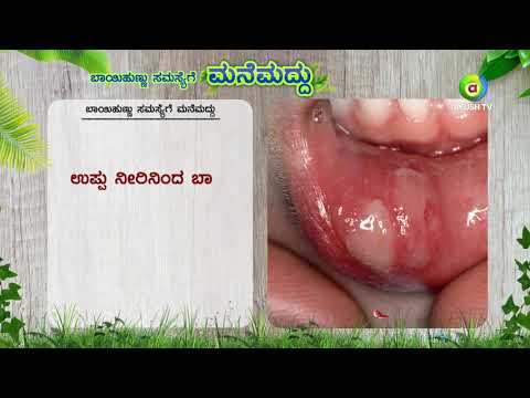 Home Remedies For Mouth ulcer | Manemaddu | Ayush TV | Home Remedies
