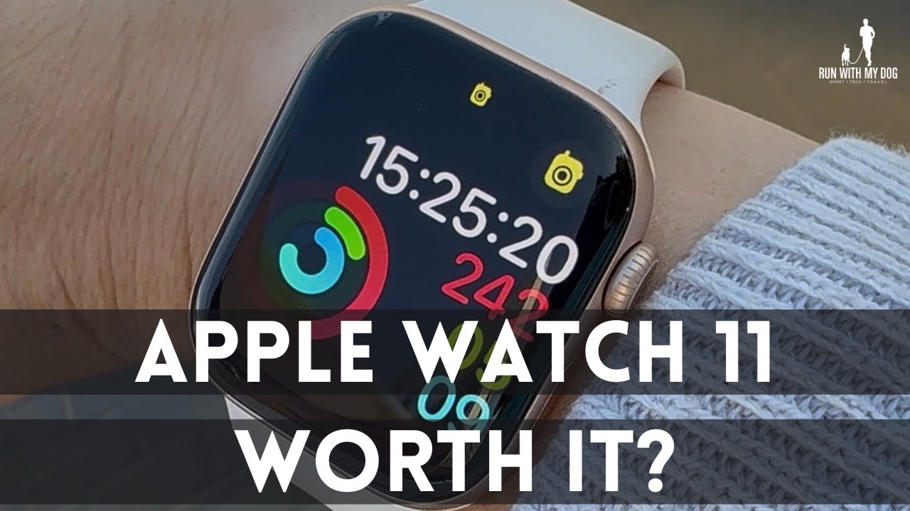 Apple Watch Series 11 — 10 Things You Should Actually Know