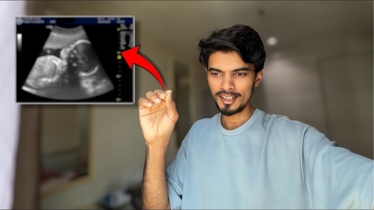 BOY BABY..!! 😂🤣😂🤣 ARREST..??