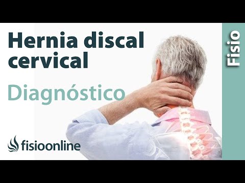 La innovación en el tratamiento de la hernia vertebral La hipertrofia del ligamento amarillo de la columna cervical