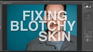 Fixing Red Blotchy Skin Tones in Photoshop