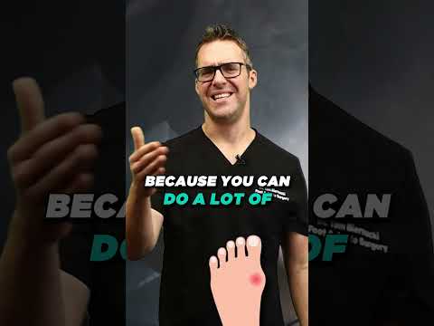 TOP 13 Ways to Shrink Bunions Naturally 1 HUGE SECRET