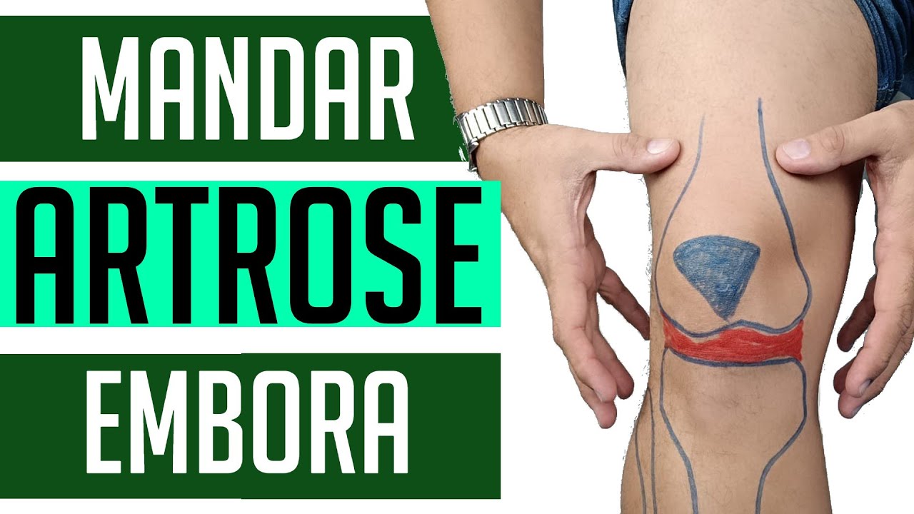 ARTROSE NO JOELHO - 4 EXERCÍCIOS PARA MELHORAR AGORA!