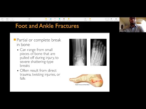 Podiatrist Shares Advice & Treatment Options on Common Foot & Ankle Problems