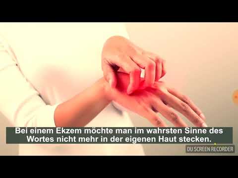 Zinkowaja und salizilowaja die Salbe von der Schuppenflechte die Rezensionen Welche Tabletten oder die Salben von der Schuppenflechte