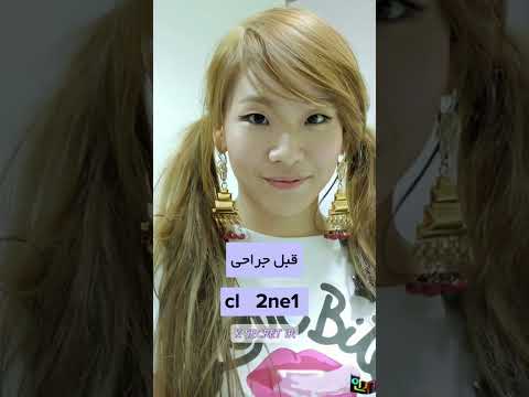 آیدل هایی که عمل زیبایی انجام دادن😐😳🤨#کیپاپ #بلک_پینک #بی_تی_اس #کره_جنوبی