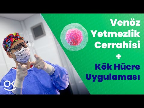Damar Sağlığınızı Kök Hücrelerle Yenileyin: Venöz Yetmezlik Cerrahisi