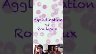 Agglutination versus Rouleaux