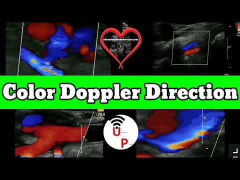 Color Flow Doppler Direction Tutorial