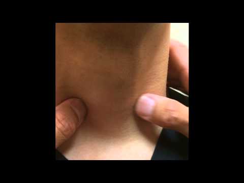 An Easier Thyroid Exam