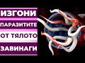 ТЕЗИ 8 СУПЕР ХРАНИ ЩЕ ИЗГОНЯТ ВСИЧКИ ПАРАЗИТИ ОТ ТЯЛОТО ВИ ЗАВИНАГИ!