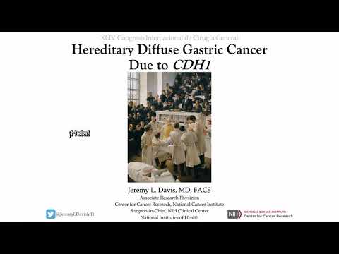 Cáncer gástrico hereditario difuso - Dr.  Jeremy L.  Davis