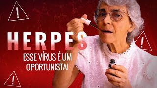 Herpes labial: o que fazer