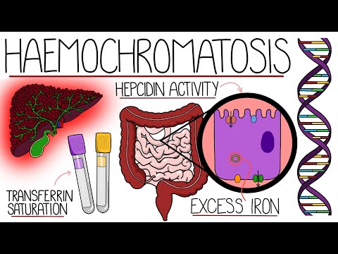 Understanding Wilson s Disease Hepatolenticular Degeneration