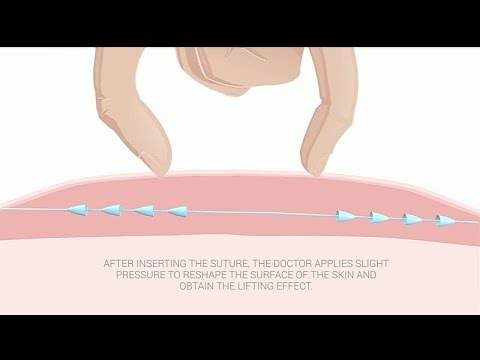 CoolBody Contours offers a facelift without surgery, no downtime