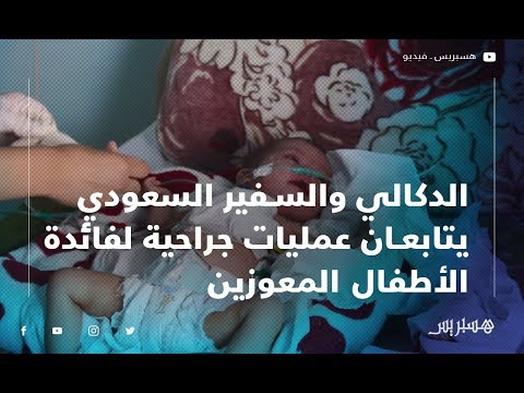 الدكالي والسفير السعودي يتابعان عمليات جراحية لفائدة الأطفال المعوزين