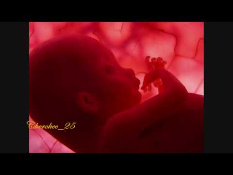 Aborto - Akwid