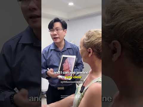 Update 11 Days #fullface  #deepplanefacelift #necklift #liplift #transformation