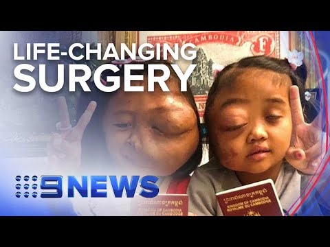 Cambodian girls undergoing facial surgery in Australia | Nine News Australia