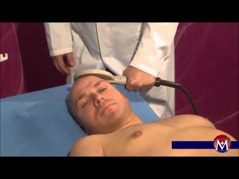 NEUROLOGY / (PMR) Evoked Potentials MEP