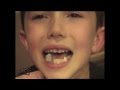 CuteWinFail Lego Stuck In Kid S Mouth Fail