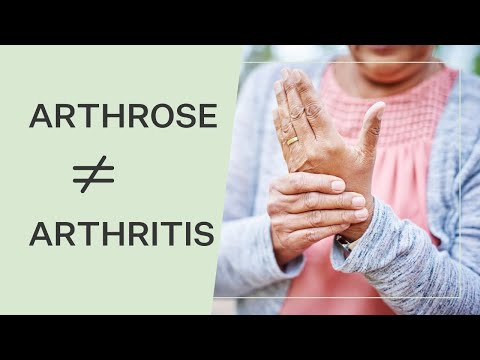 Arthrose und Arthritis: Wir erklären, worin genau der Unterschied liegt!