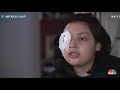 California Fast Food Worker To Lose Eye After Customer Attack - Video
