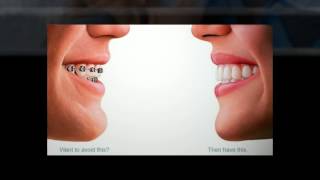 preview picture of video 'Aurora Orthodontics practice Producing Great Smiles | (303) 617-3333'