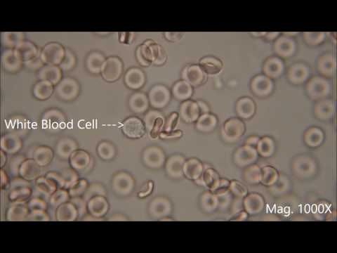 Red blood cells under the microscope, hypo and hypertonic solutions