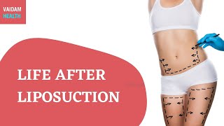 Life after Liposuction
