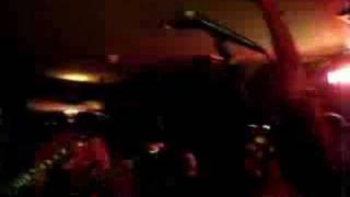 Hey Kiddo Trophy Scars