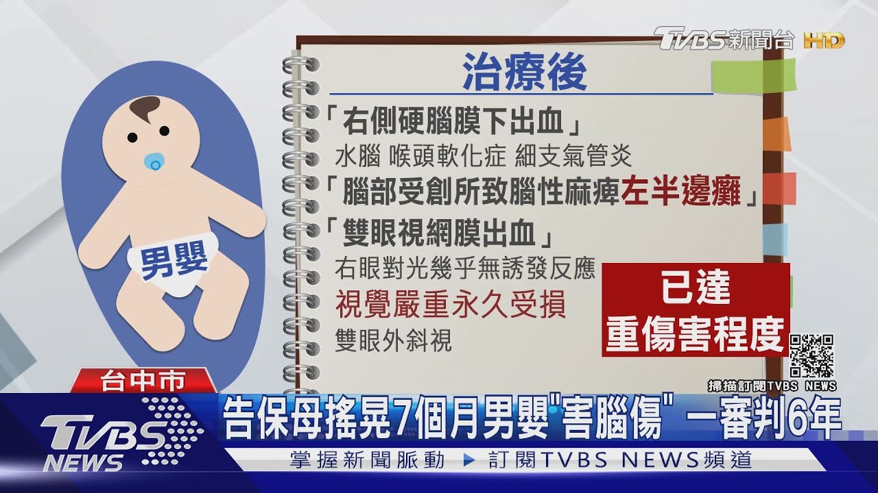 告保母搖晃7個月男嬰「害腦傷」 一審判6年