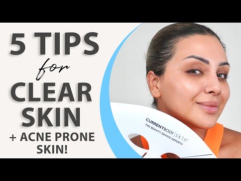 5 TIPS FOR CLEARER SKIN GREAT FOR ACNE | NINA UBHI