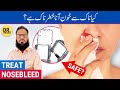 Nakseer Ka Ilaj - Nosebleed Causes & Treatment - Naak Se Khoon Aane Ki Wajah/Ilaj - Urdu/Hindi