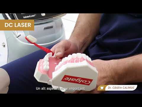 Detaliul ignorat care influențează sănătatea orală | Campanie de sănătate orală