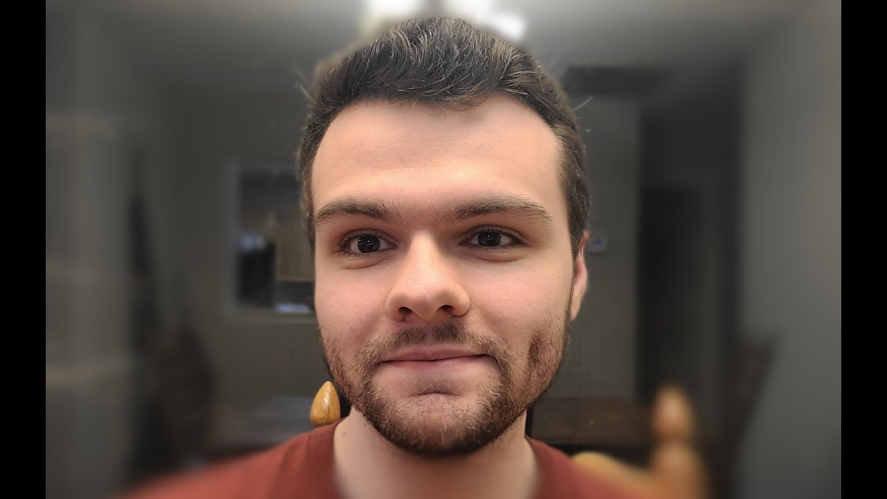 Ketamine infusion therapy experience, and other fun AvPD stuff!