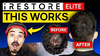 iRESTORE Elite Review 2026: Most POWERFUL At-home Device for Hair Loss? | DISCOUNT INSIDE