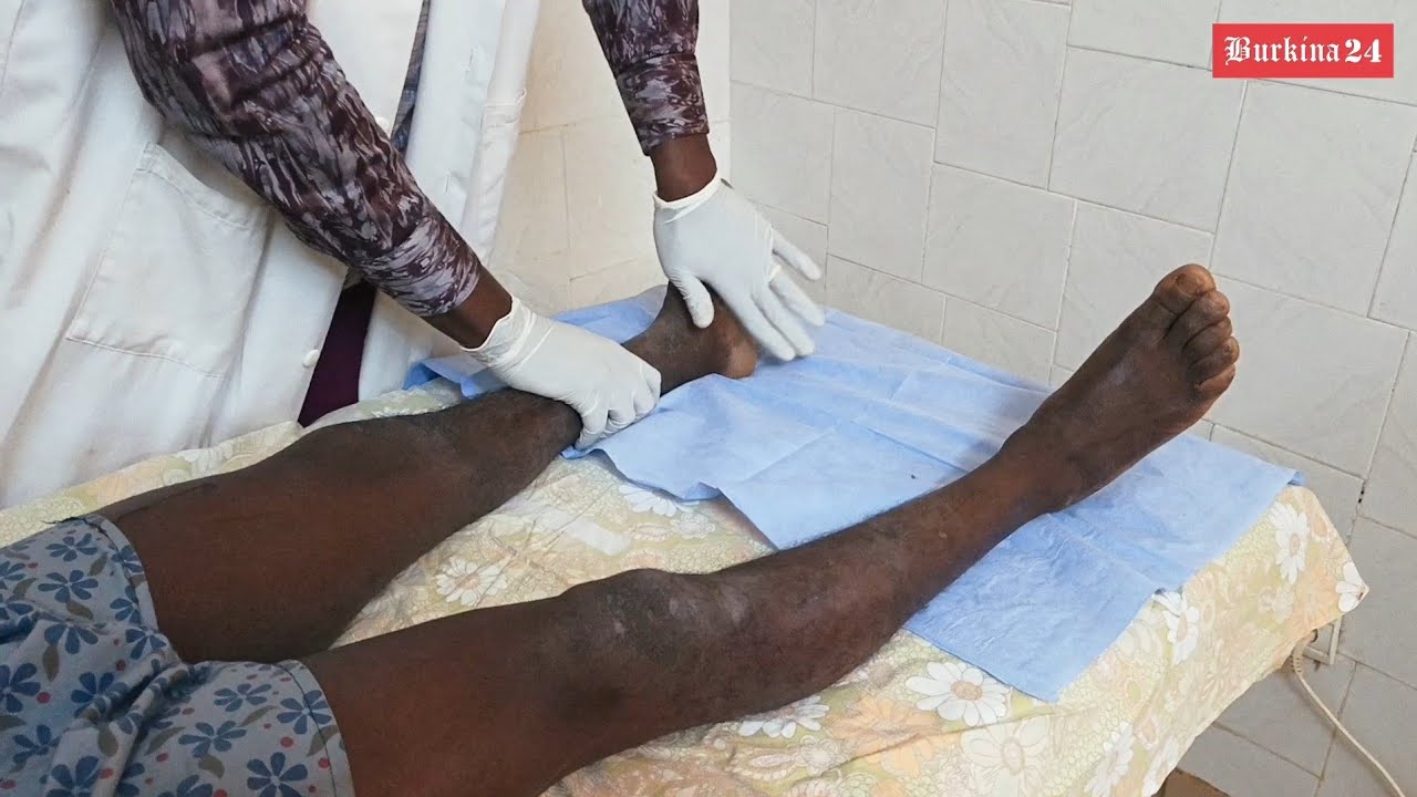 Kaya/Burkina Faso : Dr Marius Nézien développe une expertise afin de sauver des vies