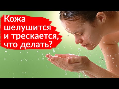 Внешние признаки веснушек Отбеливающие крема для лица летом