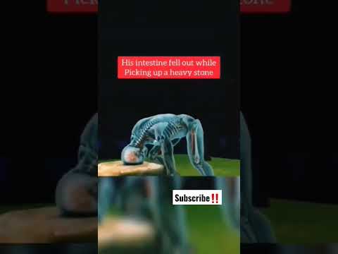 worst ways people have died 😳💔 #subscribe #shorts